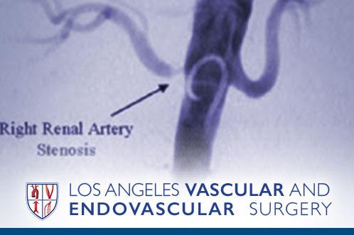 Angiography