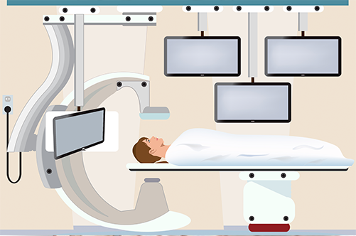 Renovascular Conditions