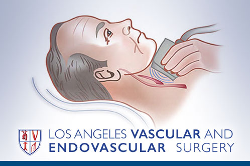 Vascular Ultrasound